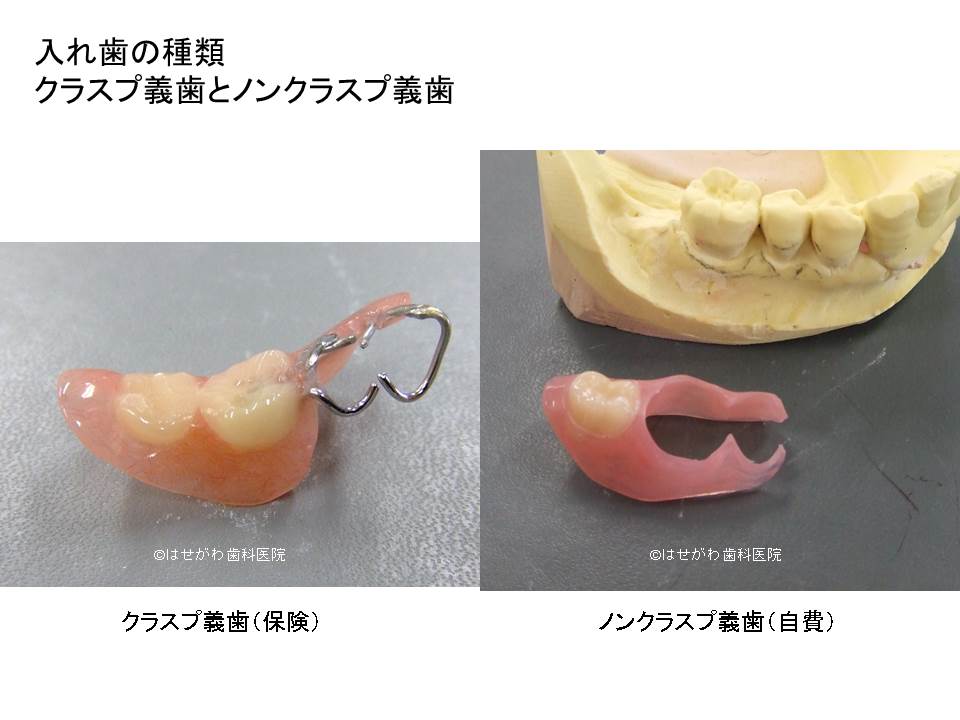 入れ歯保険と自費